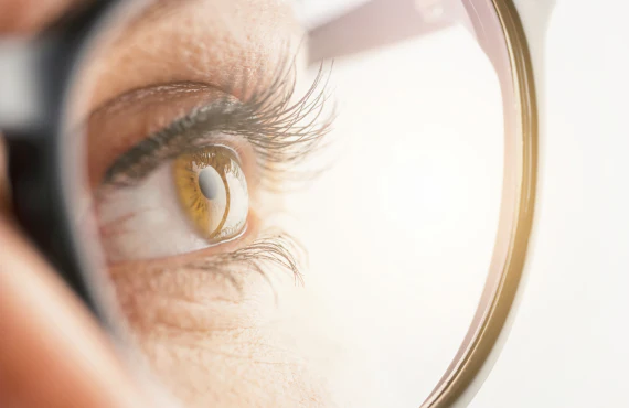 Vision